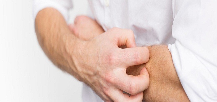 انواع الحكة الجلدية