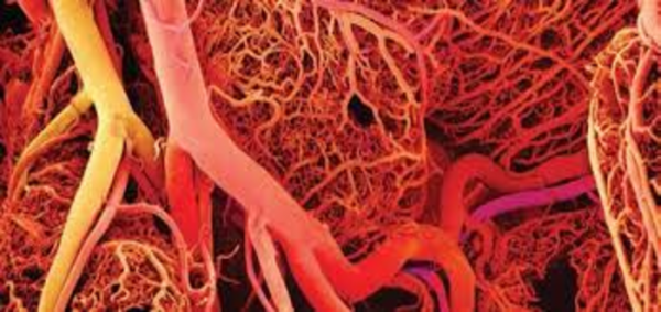 تشوهات الأوعية الدموية