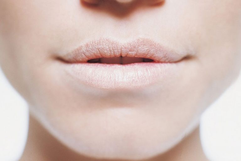 أسباب بياض الشفايف أسباب بياض الشفايف