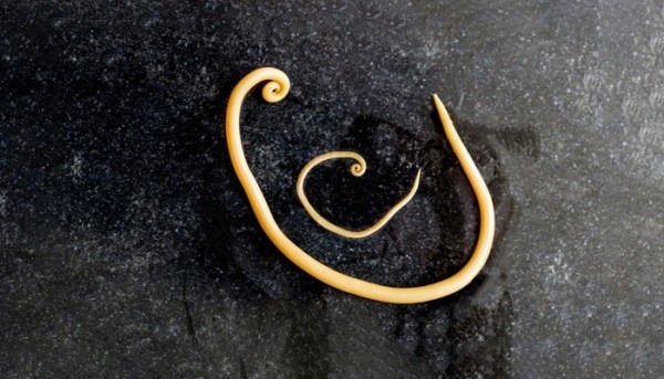 معلومات عن الديدان الخيطية