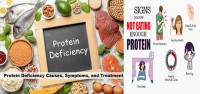 كيف اعوض نقص البروتين كيف اعوض نقص البروتين