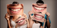 كم يدوم تبييض الأسنان كم يدوم تبييض الأسنان