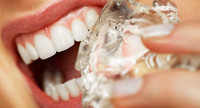 عادات تدمر صحة الاسنان