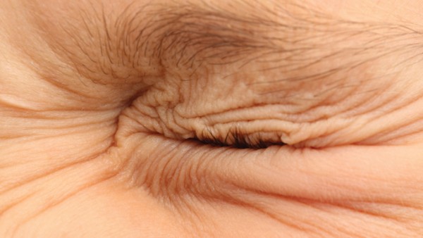 أسباب تشنج الجفن أسباب تشنج الجفن