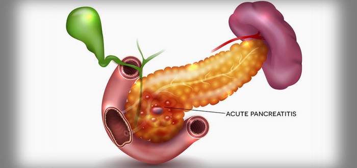 الخلايا الملفوفة قد تكون سبب التهابات البنكرياس