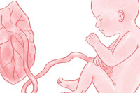 اعراض انفصال المشيمة اعراض انفصال المشيمة