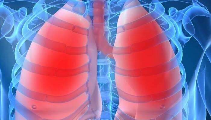 أهمية جهاز تنقية الهواء لمرضى الربو