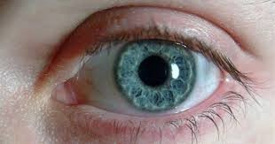 الممنوعات بعد زراعة القرنية الممنوعات بعد زراعة القرنية