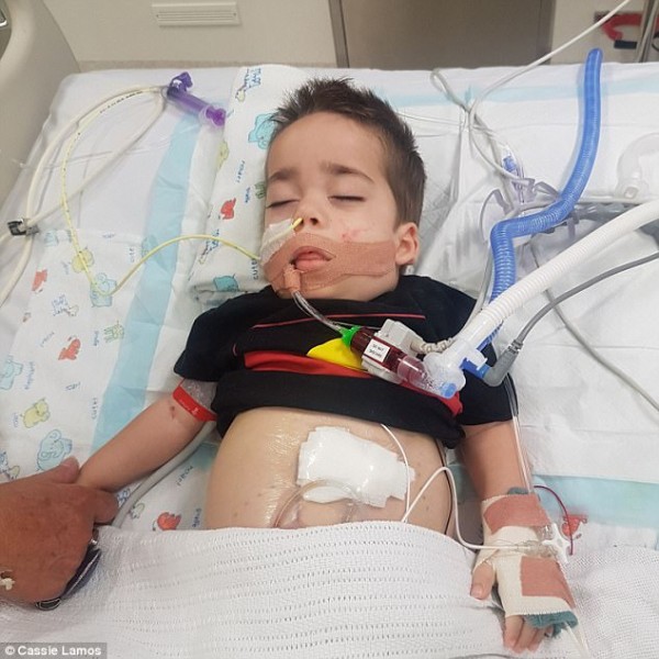 مرض نيمان بيك .. أنواعه وأعراضه والتشخيص والعلاج مرض نيمان بيك .. أنواعه وأعراضه والتشخيص والعلاج