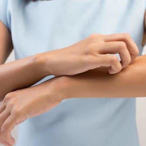 الحساسية العصبية