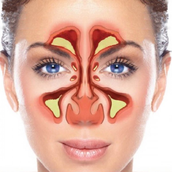 ما هي الجيوب الانفية