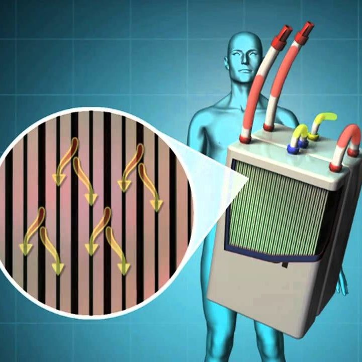 ما هي الكلى الصناعية ما هي الكلى الصناعية