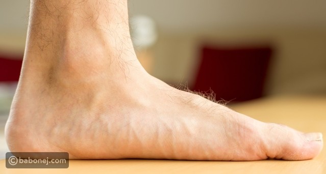 فلات فوت القدم بالأسباب وطرق العلاج