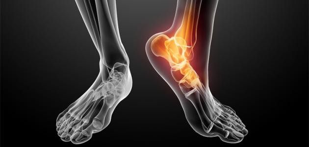 أسباب آلام المفاصل والعظام أسباب آلام المفاصل والعظام