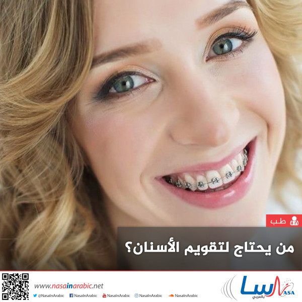 من يحتاج لتقويم الأسنان؟ من يحتاج لتقويم الأسنان؟