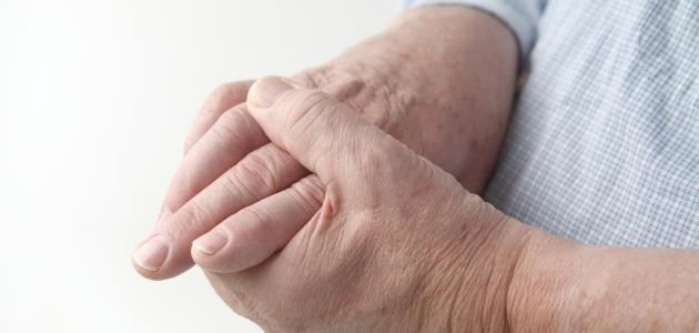 تشخيص النقرس تشخيص النقرس
