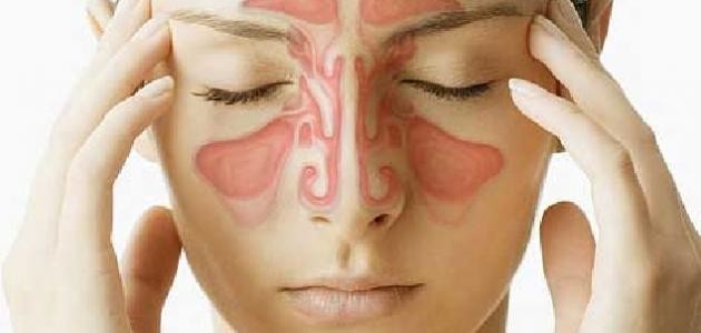ما هي أعراض الجيوب الأنفية ما هي أعراض الجيوب الأنفية