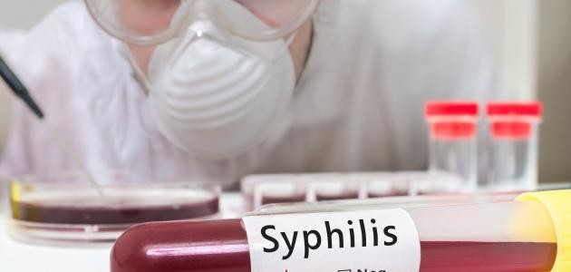 شخصيات بارزة اصيبت بالزهري شخصيات بارزة اصيبت بالزهري