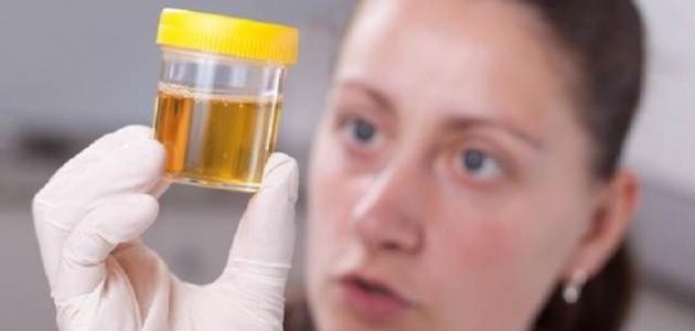 ما سبب تغير لون البول ما سبب تغير لون البول