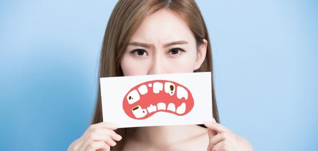 تعريف تسوس الأسنان تعريف تسوس الأسنان