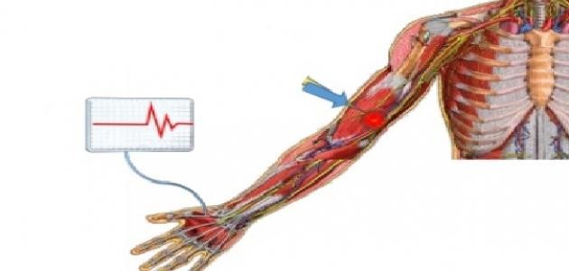 ما هو تخطيط الأعصاب ما هو تخطيط الأعصاب