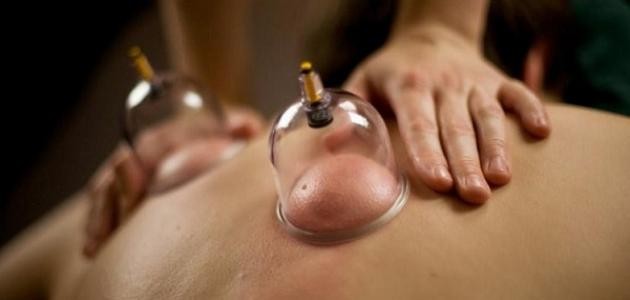 ما هي فوائد الحجامة للرجال ما هي فوائد الحجامة للرجال