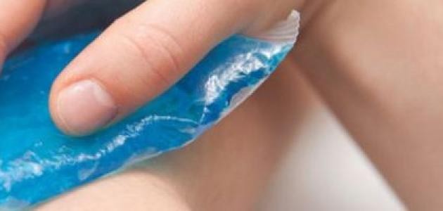 كيفية علاج الكدمات كيفية علاج الكدمات