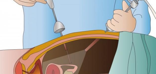 التنظير الرّحمي التنظير الرّحمي