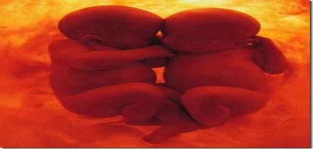 متى يظهر التوأم بالسونار متى يظهر التوأم بالسونار