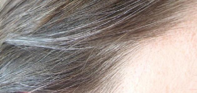 طريقة علاج الشعر الأبيض طريقة علاج الشعر الأبيض
