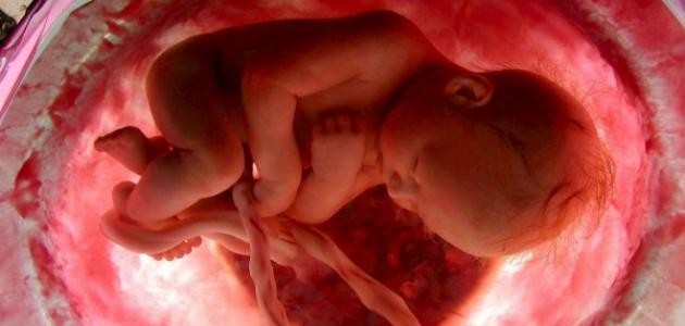 ما هو انفجار الرحم