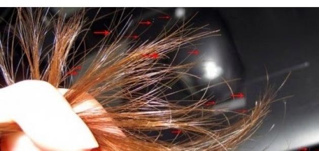 كيف أعالج تقصف شعري كيف أعالج تقصف شعري