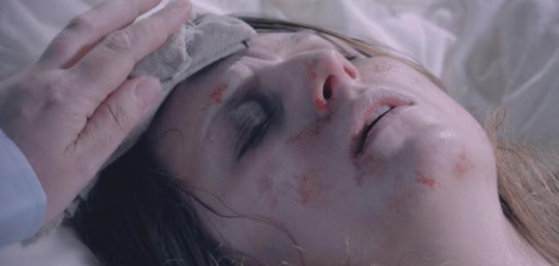 ما هي حمى التيفوئيد