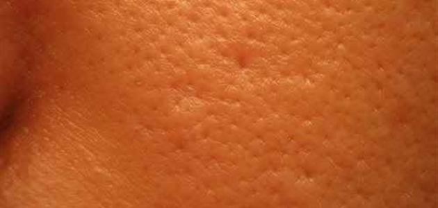 كيف تتخلص من مسامات الوجه كيف تتخلص من مسامات الوجه