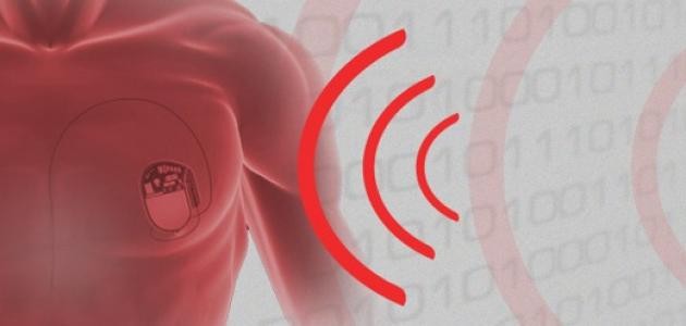 ما هو علاج كهرباء القلب ما هو علاج كهرباء القلب