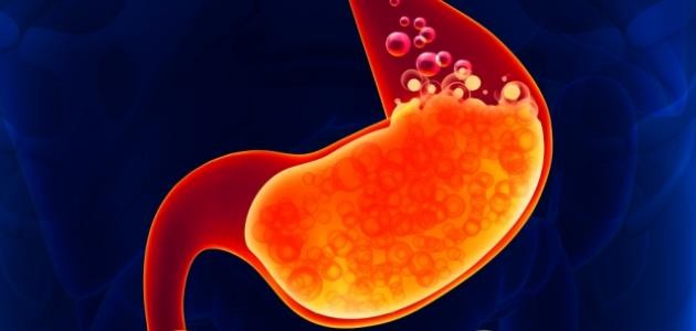 كيف تعالج حرقة المعدة