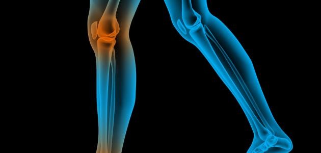 عمليات تطويل العظام وعلاج الكسور والتشوهات عمليات تطويل العظام وعلاج الكسور والتشوهات