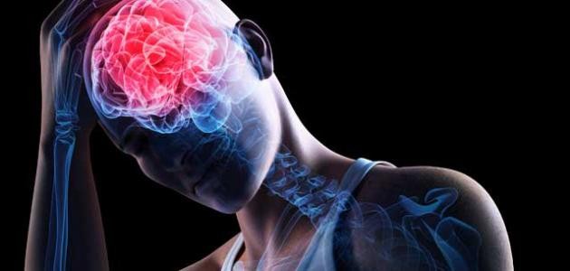 ما هو ارتجاج المخ