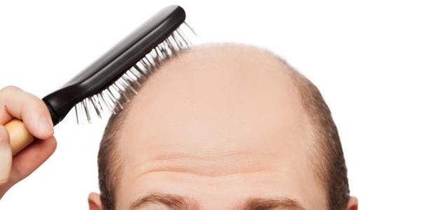 ما هي الأمراض التي تسبب تساقط الشعر ما هي الأمراض التي تسبب تساقط الشعر