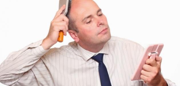 كيف تخفي الصلع