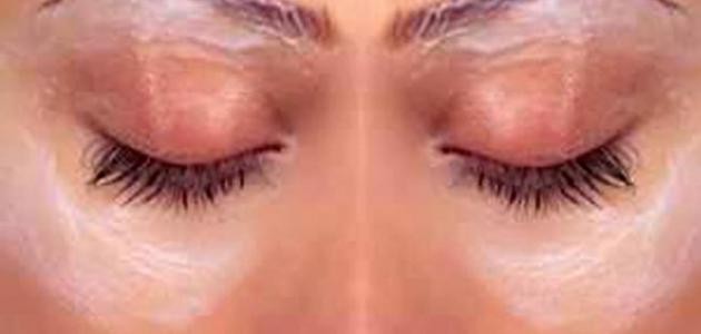 ما علاج السواد حول العينين ما علاج السواد حول العينين
