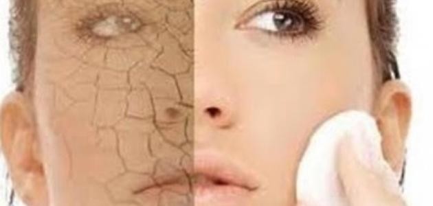 كيف أتخلص من جفاف البشره كيف أتخلص من جفاف البشره