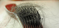 أسباب تساقط الشعر بغزارة وعلاجه أسباب تساقط الشعر بغزارة وعلاجه