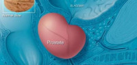 ما هو تضخم البروستات ما هو تضخم البروستات